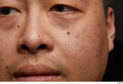 Man Asian Chubby Face Skin Textures